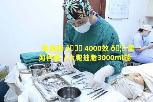 腿抽脂 🐝 4000效 🦅 果如何呢（大腿抽脂3000ml能瘦多少厘米）